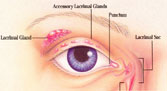 Los Angeles Eye Doctor - Dry Eye Photo
