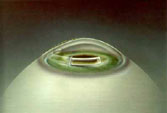 Los Angeles Intacs - Eye Photo