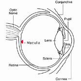 Los Angeles Macular Degeneration Photo
