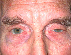 Los Angeles Reconstructive Surgery Before Photo