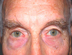 Los Angeles Reconstructive Surgery After Photo