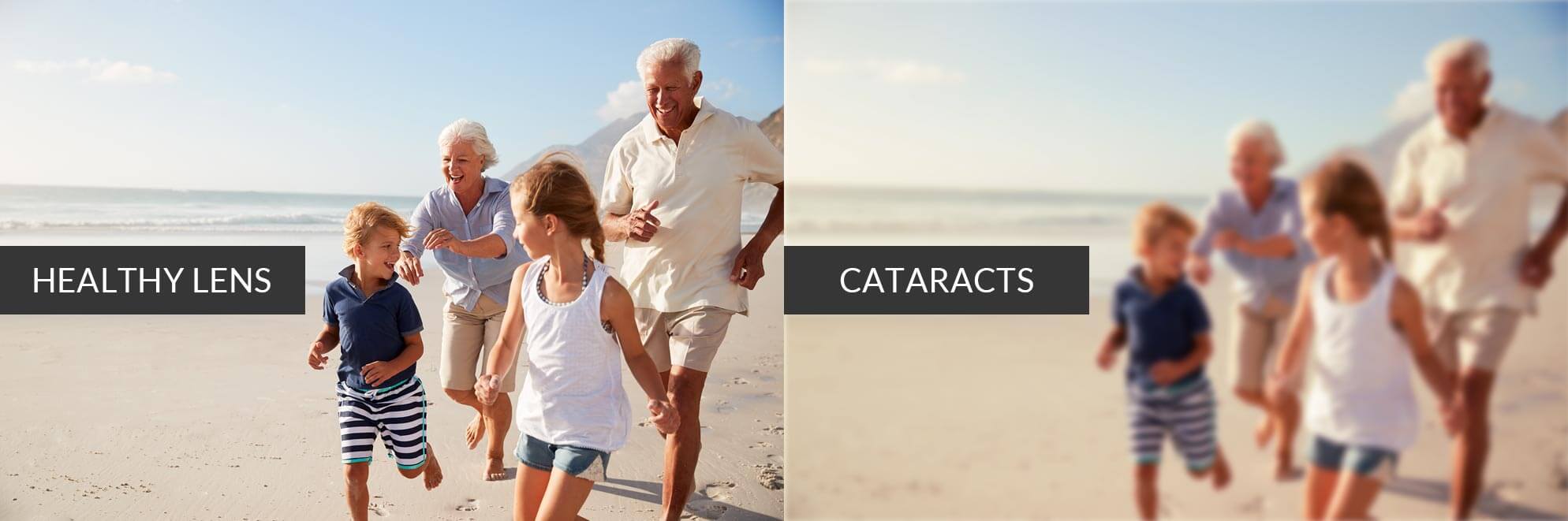 Healthy Vision and Cataract Vision