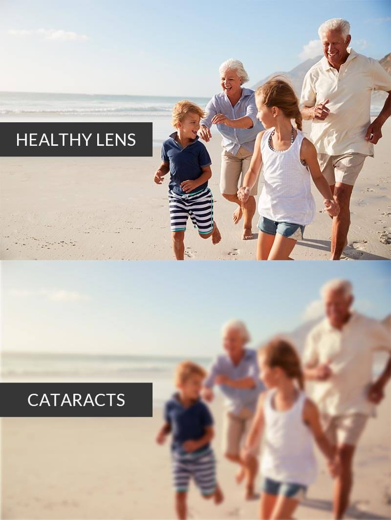 Healthy vision and cataract